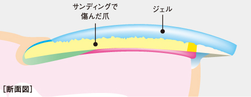 パラジェルとは Nail Amin