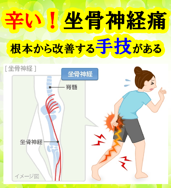 蘇我・浜野で坐骨神経痛にお困りの方へ